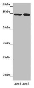 NELL1 Antibody - Western blot All lanes: NELL1 antibody at 4.52µg/ml Lane 1: Hela whole cell lysate Lane 2: Jurkat whole cell lysate Secondary Goat polyclonal to rabbit IgG at 1/10000 dilution Predicted band size: 90, 85 kDa Observed band size: 85 kDa