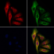 NELL1 Antibody - Staining HeLa cells by IF/ICC. The samples were fixed with PFA and permeabilized in 0.1% Triton X-100, then blocked in 10% serum for 45 min at 25°C. Samples were then incubated with primary Ab(1:200) and mouse anti-beta tubulin Ab(1:200) for 1 hour at 37°C. An AlexaFluor594 conjugated goat anti-rabbit IgG(H+L) Ab(1:200 Red) and an AlexaFluor488 conjugated goat anti-mouse IgG(H+L) Ab(1:600 Green) were used as the secondary antibod
