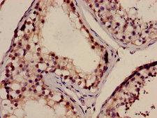 NELL2 Antibody - Immunohistochemistry image of paraffin-embedded human testis tissue at a dilution of 1:100