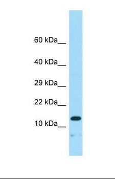NENF / Neudesin Antibody - Western blot of Human Fetal Heart. NENF antibody dilution 1.0 ug/ml.  This image was taken for the unconjugated form of this product. Other forms have not been tested.