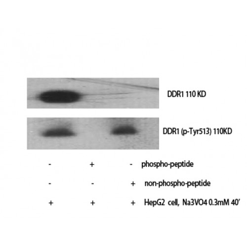 NEP / DDR1 Antibody - Western blot of Phospho-DDR1 (Y513) antibody