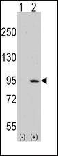 NEP / DDR1 Antibody - Western blot of DDR1 (arrow) using rabbit polyclonal DDR1 Antibody. 293 cell lysates (2 ug/lane) either nontransfected (Lane 1) or transiently transfected with the DDR1 gene (Lane 2) (Origene Technologies).