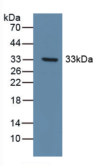 NEP / DDR1 Antibody