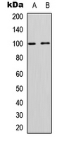 NEP / DDR1 Antibody - Western blot analysis of CD167a expression in Jurkat (A); rat muscle (B) whole cell lysates.