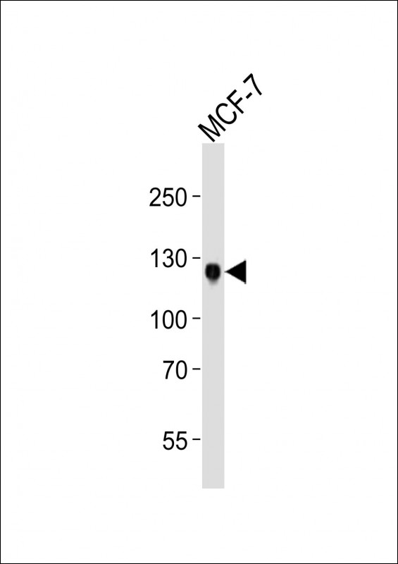 NEP / DDR1 Antibody - Western blot of lysate from MCF-7 cell line, using DDR1 antibody diluted at 1:1000. A goat anti-rabbit IgG H&L (HRP) at 1:10000 dilution was used as the secondary antibody. Lysate at 20 ug.