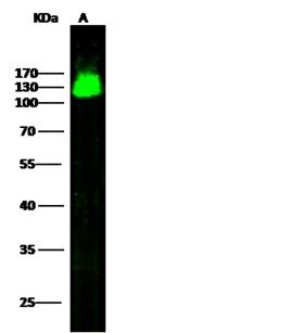 NEP / DDR1 Antibody - Anti-DDR1 rabbit monoclonal antibody at 1:500 dilution. Lane A: MCF7 Whole Cell Lysate. Lysates/proteins at 30 ug per lane. Secondary: Goat Anti-Rabbit IgG H&L (Dylight800) at 1/10000 dilution. Developed using the Odyssey technique. Performed under reducing conditions. Predicted band size: 101 kDa. Observed band size: 130 kDa.