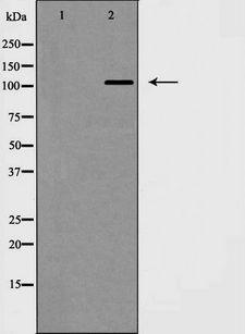 NEP / DDR1 Antibody - Western blot analysis of DDR1 expression in JK cells. The lane on the left is treated with the antigen-specific peptide.