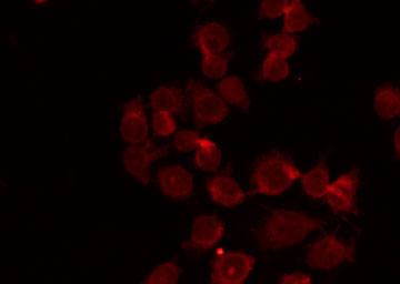 NEP / DDR1 Antibody - Staining HepG2 cells by IF/ICC. The samples were fixed with PFA and permeabilized in 0.1% Triton X-100, then blocked in 10% serum for 45 min at 25°C. The primary antibody was diluted at 1:200 and incubated with the sample for 1 hour at 37°C. An Alexa Fluor 594 conjugated goat anti-rabbit IgG (H+L) Ab, diluted at 1/600, was used as the secondary antibody.