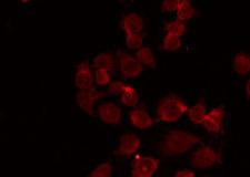 NEP / DDR1 Antibody - Staining HepG2 cells by IF/ICC. The samples were fixed with PFA and permeabilized in 0.1% Triton X-100, then blocked in 10% serum for 45 min at 25°C. The primary antibody was diluted at 1:200 and incubated with the sample for 1 hour at 37°C. An Alexa Fluor 594 conjugated goat anti-rabbit IgG (H+L) Ab, diluted at 1/600, was used as the secondary antibody.