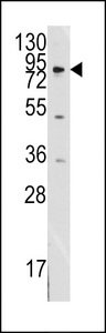 NEP / DDR1 Antibody - Western blot of anti-MCK10 antibody in SK-BR-3 cell line lysates (35 ug/lane). MCK10 (arrow) was detected using the purified antibody.