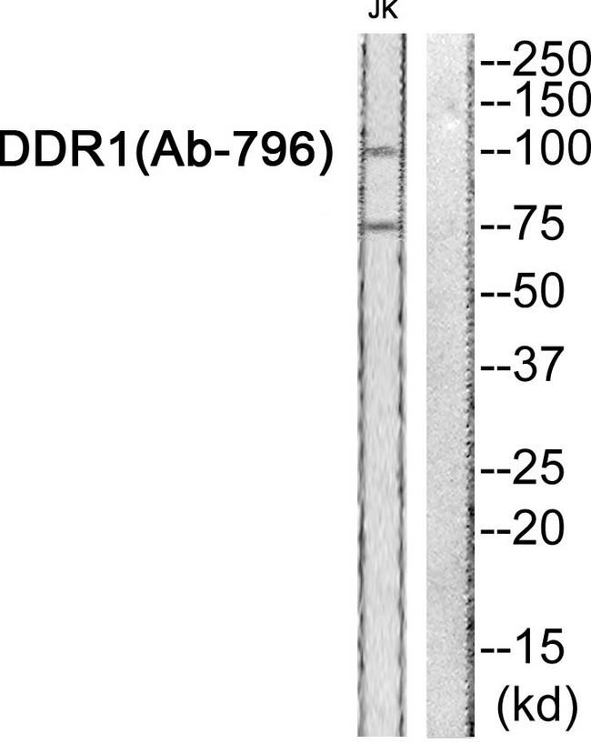 NEP / DDR1 Antibody - Western blot analysis of extracts from JK cells, using DDR1 (Ab-796) antibody.