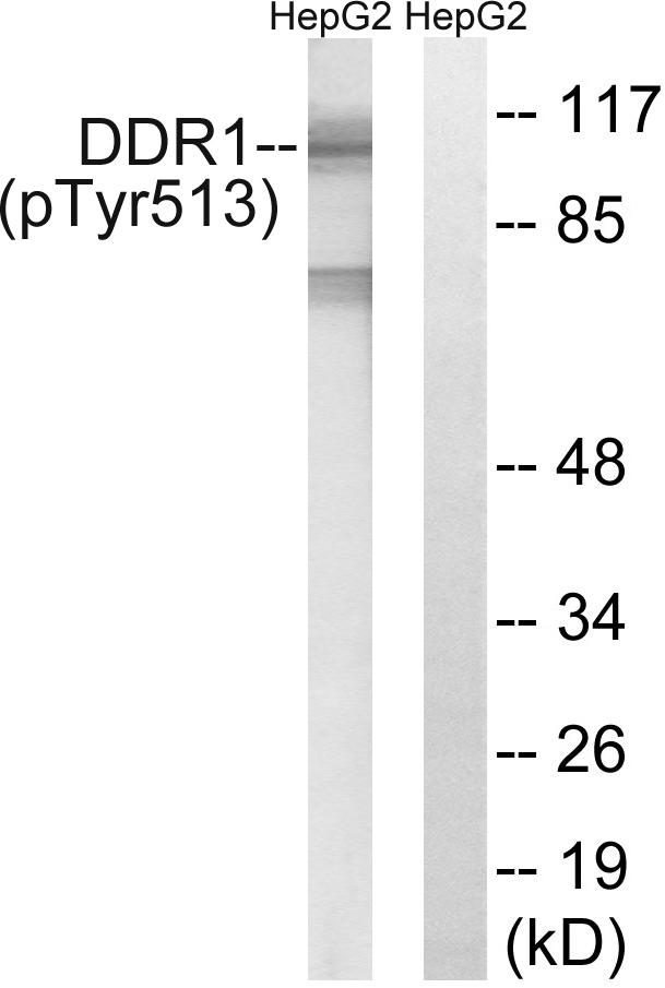 NEP / DDR1 Antibody - Western blot analysis of extracts from HepG2 cells, treated with Na3VO4 (0.3mM, 40mins), using DDR1 (Phospho-Tyr513) antibody.