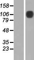 NEP / DDR1 Protein - Western validation with an anti-DDK antibody * L: Control HEK293 lysate R: Over-expression lysate