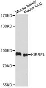 NEPH1 / KIRREL Antibody - Western blot analysis of extracts of various cell lines, using KIRREL antibody at 1:1000 dilution. The secondary antibody used was an HRP Goat Anti-Rabbit IgG (H+L) at 1:10000 dilution. Lysates were loaded 25ug per lane and 3% nonfat dry milk in TBST was used for blocking. An ECL Kit was used for detection and the exposure time was 30s.