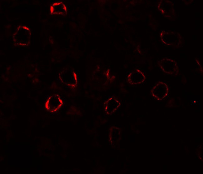NEPH2 / KIRREL3 Antibody - Immunofluorescence of KIRREL3 in mouse kidney tissue with KIRREL3 antibody at 20 ug/ml.