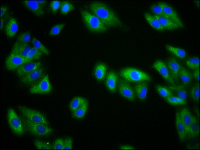 NEPH2 / KIRREL3 Antibody - Immunofluorescence staining of HepG2 cells diluted at 1:133, counter-stained with DAPI. The cells were fixed in 4% formaldehyde, permeabilized using 0.2% Triton X-100 and blocked in 10% normal Goat Serum. The cells were then incubated with the antibody overnight at 4°C.The Secondary antibody was Alexa Fluor 488-congugated AffiniPure Goat Anti-Rabbit IgG (H+L).