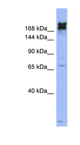 NES / Nestin Antibody - NES / Nestin antibody Western blot of OVCAR-3 cell lysate. This image was taken for the unconjugated form of this product. Other forms have not been tested.