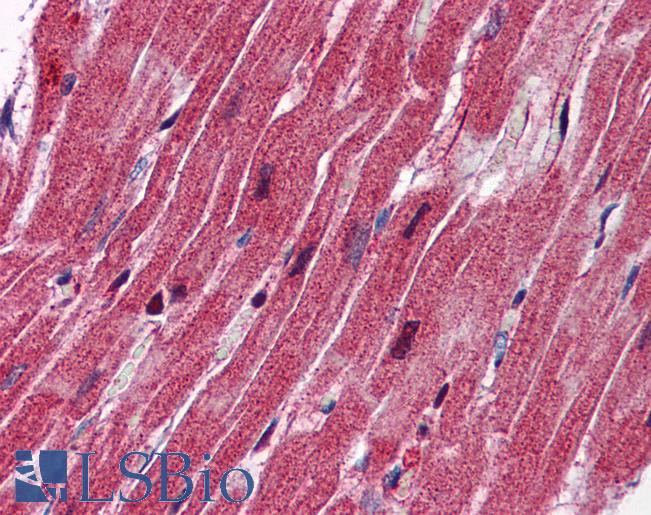 NES / Nestin Antibody - Anti-Nestin antibody IHC of human heart. Immunohistochemistry of formalin-fixed, paraffin-embedded tissue after heat-induced antigen retrieval. Antibody concentration 2.5 ug/ml.  This image was taken for the unconjugated form of this product. Other forms have not been tested.