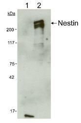 NES / Nestin Antibody - Nestin Antibody (10C2) - Detection of human nestin.  Lane 1: 5 ug total rat brain protein, lane 2: 5 ug human CNS progenitor cell protein.  This image was taken for the unconjugated form of this product. Other forms have not been tested.