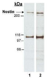 NES / Nestin Antibody - Detection of nestin protein in human fetal temporal lobe tissue lysates (30 ug). Lane 1: 0.5 ug/ml: lane 2: 2 ug/ml. ECL: 1 second exposure.  This image was taken for the unconjugated form of this product. Other forms have not been tested.