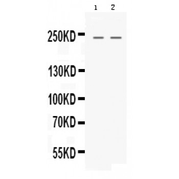 NES / Nestin Antibody - Western blot analysis of Nestin expression in HELA whole cell lysates (lane 1) and HEPG2 whole cell lysates (lane 2). Nestin at 230 kD was detected using rabbit anti- Nestin Antigen Affinity purified polyclonal antibody at 0.5 ug/mL. The blot was developed using chemiluminescence (ECL) method.