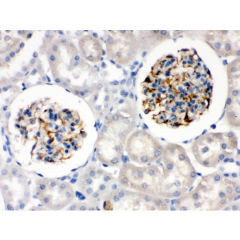 NES / Nestin Antibody - Nestin was detected in paraffin-embedded sections of rat kidney tissues using rabbit anti- Nestin Antigen Affinity purified polyclonal antibody at 1 ug/mL. The immunohistochemical section was developed using SABC method.