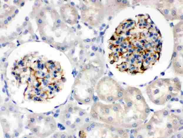NES / Nestin Antibody - Nestin was detected in paraffin-embedded sections of rat kidney tissues using rabbit anti-Nestin Antigen Affinity purified polyclonal antibody at 1 ug/ml. The immunohistochemical section was developed using SABC method