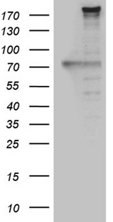 NES / Nestin Antibody - HEK293T cells were transfected with the pCMV6-ENTRY control. (Left lane) or pCMV6-ENTRY NES. (Right lane) cDNA for 48 hrs and lysed. Equivalent amounts of cell lysates. (5 ug per lane) were separated by SDS-PAGE and immunoblotted with anti-NES. (1:500)