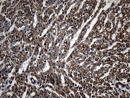 NES / Nestin Antibody - Immunohistochemical staining of paraffin-embedded Human adult heart tissue within the normal limits using anti-NES mouse monoclonal antibody. (Heat-induced epitope retrieval by 1mM EDTA in 10mM Tris buffer. (pH8.5) at 120 oC for 3 min. (1:2000)