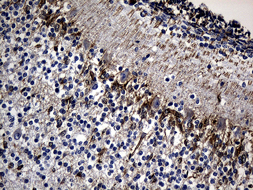 NES / Nestin Antibody - Immunohistochemical staining of paraffin-embedded Human embryonic cerebellum within the normal limits using anti-NES mouse monoclonal antibody. (Heat-induced epitope retrieval by 1mM EDTA in 10mM Tris buffer. (pH8.5) at 120 oC for 3 min. (1:2000)