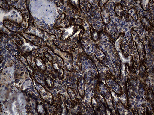 NES / Nestin Antibody - Immunohistochemical staining of paraffin-embedded Human spleen tissue within the normal limits using anti-NES mouse monoclonal antibody. (Heat-induced epitope retrieval by 1mM EDTA in 10mM Tris buffer. (pH8.5) at 120 oC for 3 min. (1:2000)