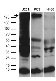 NES / Nestin Antibody - Western blot analysis of extracts. (35ug) from 3 different cell lines by using anti-NES monoclonal antibody. (1:500)