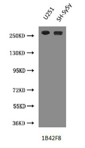 NES / Nestin Antibody - Western Blot Positive WB detected in: U251 whole cell lysate, SH-Sy5y whole cell lysate  All lanes :NES antibody at 3 ug/ml Predicted band size: 260 kDa Observed band size: 260 kDa