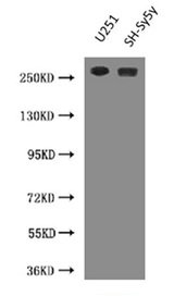 NES / Nestin Antibody - Western Blot Positive WB detected in: U251 whole cell lysate, SH-SY5Y whole cell lysate All lanes: NES antibody at 3µg/ml Secondary Goat polyclonal to Mouse IgG at 1/10000 dilution Predicted band size: 178 kDa Observed band size: 260 kDa
