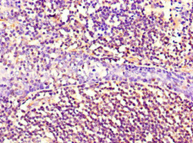 NES / Nestin Antibody - Immunohistochemistry of paraffin-embedded human tonsil tissue using NES Monoclonal Antibody at dilution of 1:100