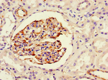 NES / Nestin Antibody - Immunohistochemistry of paraffin-embedded human kidney tissue using NES Monoclonal Antibody at dilution of 1:100