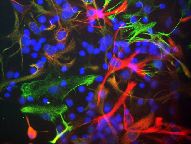 NES / Nestin Antibody - Mixed cultures of neonatal rat neurons and glia stained with Nestin antibody (red), chicken antibody to vimentin (green) and DNA (DAPI stain, blue). Astrocytes and neuronal stem cells stain strongly and specifically in a clearly filamentous fashion with the Nestin antibody antibody. The filamentous staining pattern is as expected as both Nestin and vimentin are components of 10nm filaments. Note that some cells contain Nestin, but do not stain strongly for vimentin and so appear red. Others contain vimentin and not Nestin and so appear green- these are likely to be fibroblastic or endothelial cells. Some cells express both proteins and so appear yellowish. The presence of nestin indicates that the cells are developing astrocytes, neuroblasts or undifferentiated neural stem cells.