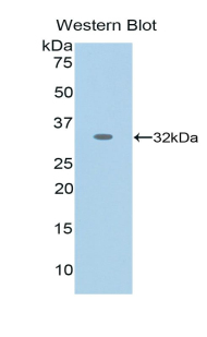 NES / Nestin Antibody - Western Blot; Sample: Recombinant protein.