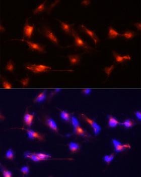 NES / Nestin Antibody - Immunofluorescence analysis of U-251MG cells using NES antibody at dilution of 1:100 (20x lens). Blue: DAPI for nuclear staining.