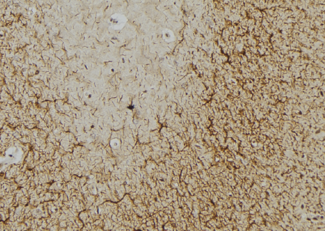 NES / Nestin Antibody - 1:100 staining mouse brain tissue by IHC-P. The sample was formaldehyde fixed and a heat mediated antigen retrieval step in citrate buffer was performed. The sample was then blocked and incubated with the antibody for 1.5 hours at 22°C. An HRP conjugated goat anti-rabbit antibody was used as the secondary.