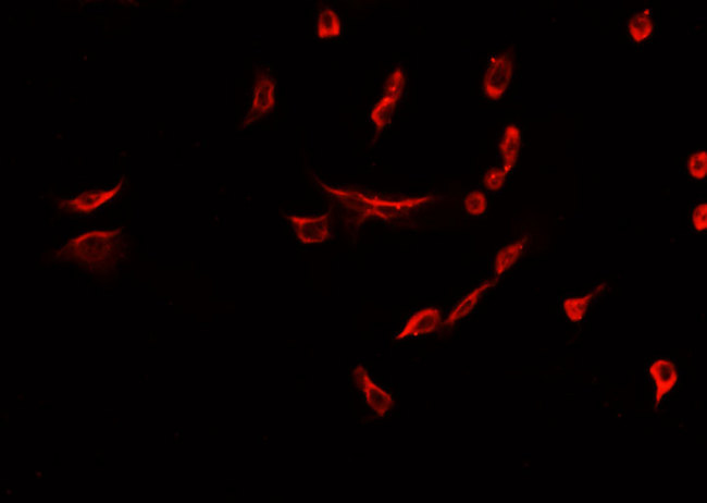 NES / Nestin Antibody - Staining HepG2 cells by IF/ICC. The samples were fixed with PFA and permeabilized in 0.1% Triton X-100, then blocked in 10% serum for 45 min at 25°C. The primary antibody was diluted at 1:200 and incubated with the sample for 1 hour at 37°C. An Alexa Fluor 594 conjugated goat anti-rabbit IgG (H+L) antibody, diluted at 1/600, was used as secondary antibody.