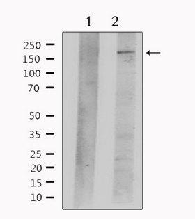 NES / Nestin Antibody - Western blot analysis of extracts of mouse brain tissue using Nestin antibody. Lane 1 was treated with the antigen-specific peptide.