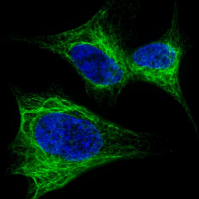 NES / Nestin Antibody - Fluorescent confocal image of SY5Y cells stained with Nestin (S1409) antibody. SY5Y cells were fixed with 4% PFA (20 min), permeabilized with Triton X-100 (0.2%, 30 min). Cells were then incubated Nestin (S1409) primary antibody (1:200, 2 h at room temperature). For secondary antibody, Alexa Fluor 488 conjugated donkey anti-rabbit antibody (green) was used (1:1000, 1h). Nuclei were counterstained with Hoechst 33342 (blue) (10 ug/ml, 5 min). Note the highly specific localization of the Nestin (S1409) immunosignal to the intermediate filaments, supported by Human Protein Atlas Data (http://www.proteinatlas.org/ENSG00000132688).
