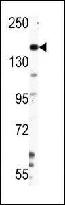 NES / Nestin Antibody - Western blot of Nestin Antibody (S1409) in HepG2 cell line lysates (35 ug/lane). NES (arrow) was detected using the purified antibody.