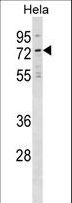 NET1 / ARHGEF8 Antibody - NET1 Antibody western blot of HeLa cell line lysates (35 ug/lane). The NET1 antibody detected the NET1 protein (arrow).