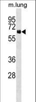 NET1 / ARHGEF8 Antibody - NET1 Antibody western blot of mouse lung tissue lysates (35 ug/lane). The NET1 antibody detected the NET1 protein (arrow).