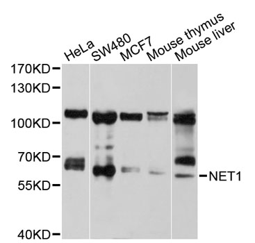 NET1 / ARHGEF8 Antibody - Western blot analysis of extracts of various cell lines, using NET1 antibody at 1:1000 dilution. The secondary antibody used was an HRP Goat Anti-Rabbit IgG (H+L) at 1:10000 dilution. Lysates were loaded 25ug per lane and 3% nonfat dry milk in TBST was used for blocking. An ECL Kit was used for detection and the exposure time was 15s.