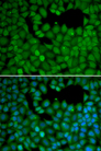NET1 / ARHGEF8 Antibody - Immunofluorescence analysis of HeLa cells using NET1 antibody. Blue: DAPI for nuclear staining.