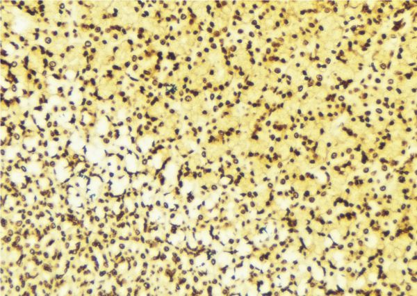 NET1 / ARHGEF8 Antibody - 1:100 staining human gastric tissue by IHC-P. The sample was formaldehyde fixed and a heat mediated antigen retrieval step in citrate buffer was performed. The sample was then blocked and incubated with the antibody for 1.5 hours at 22°C. An HRP conjugated goat anti-rabbit antibody was used as the secondary.