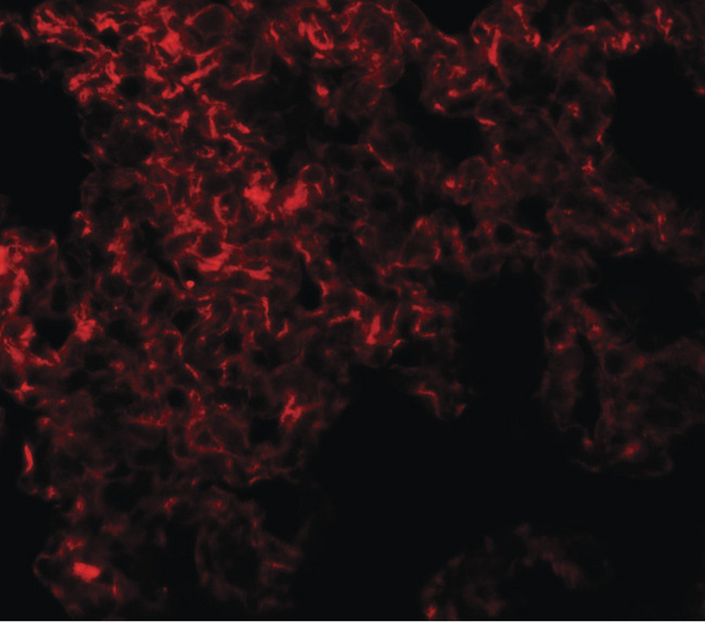 NETO1 Antibody - Immunofluorescence of NETO1 in rat lung tissue with NETO1 antibody at 20 ug/ml.